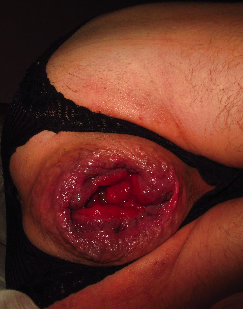 Extreme prolapse gape asshole by Marques #9965726