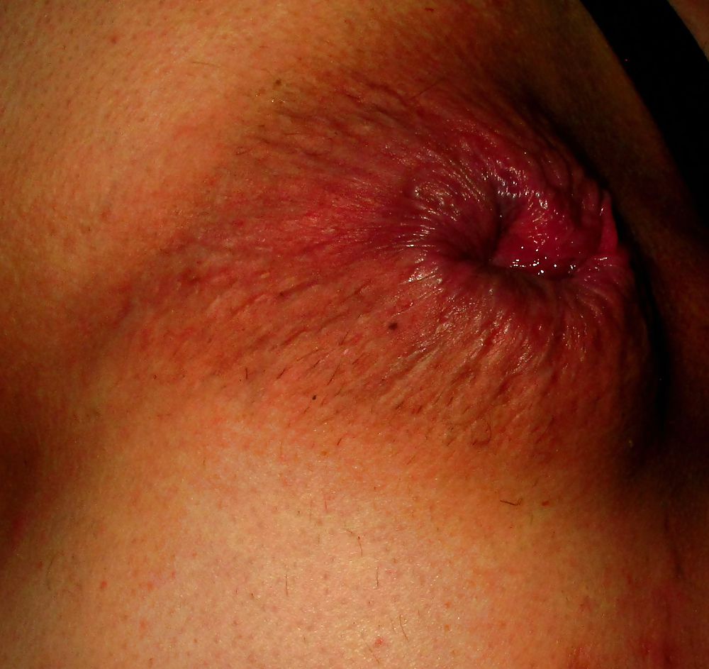 Extreme prolapse gape asshole by Marques #9965739