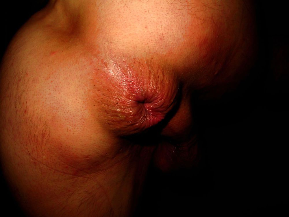 Extreme prolapse gape asshole by Marques #9965751