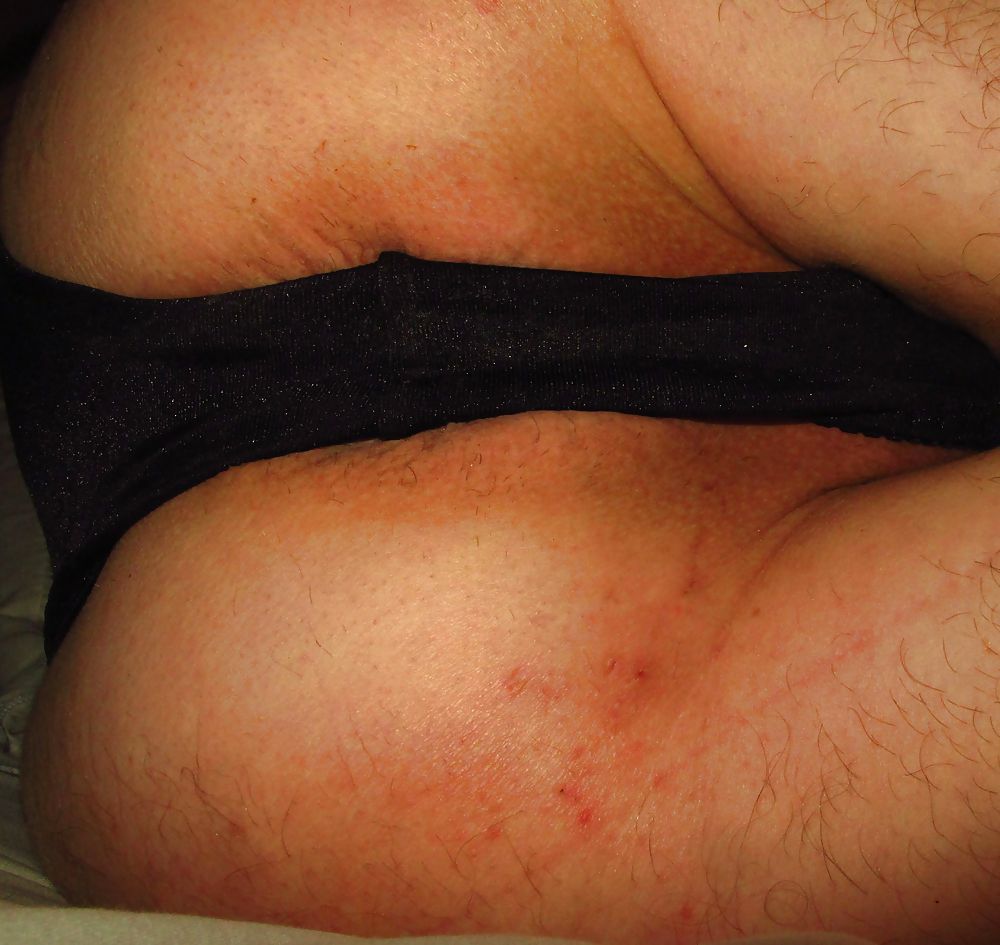Coarse prolapse peep asshole by Marques #9965773