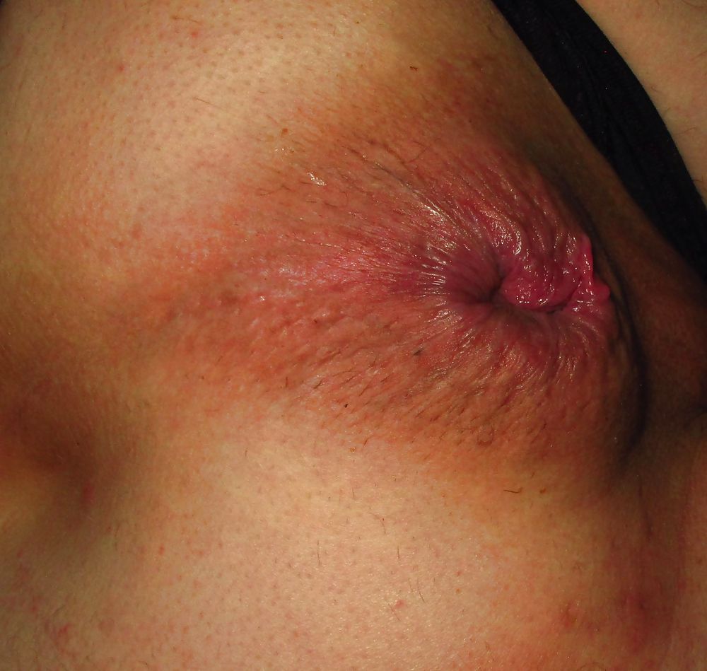 Coarse prolapse peep asshole by Marques #9965831