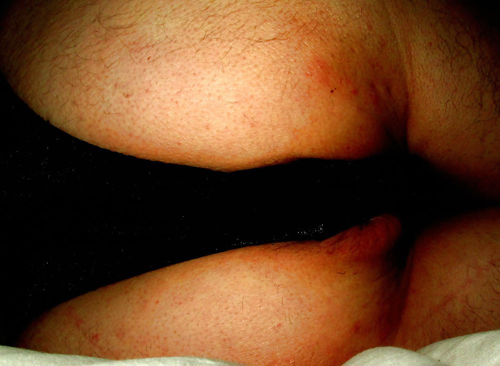 Extreme prolapse gape asshole by Marques #9965871