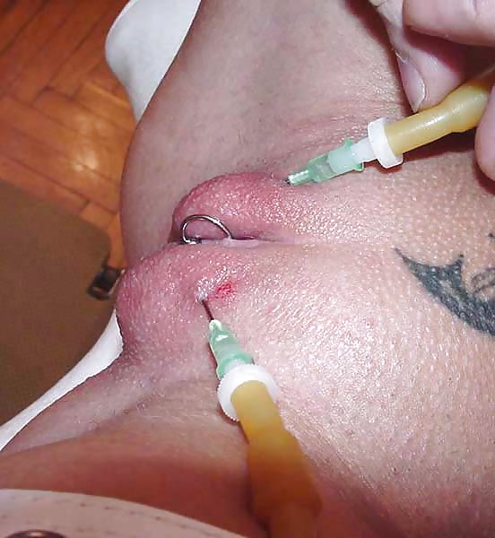 Salin injection pussy and nipples by SWE Master #21622432