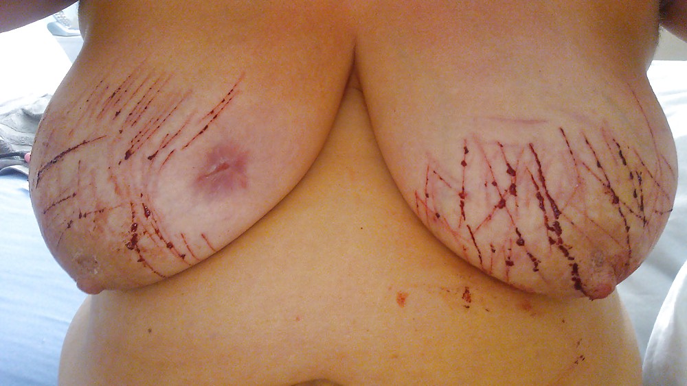 Scottish slut - variety #8984622