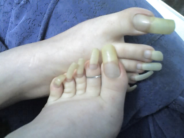 My long toenails #8950305