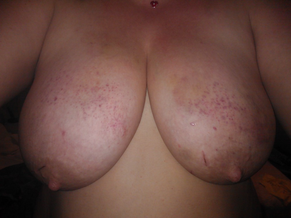 Scottish slut - punished tits #18579971