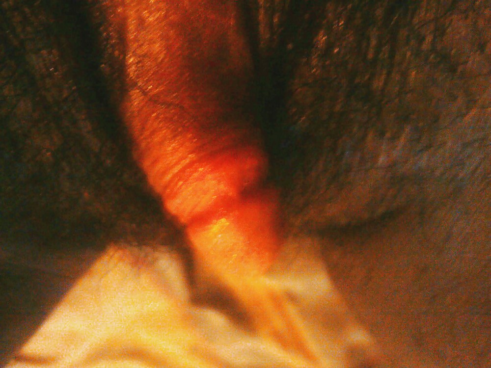 Ftm cl-ick
 #4803583