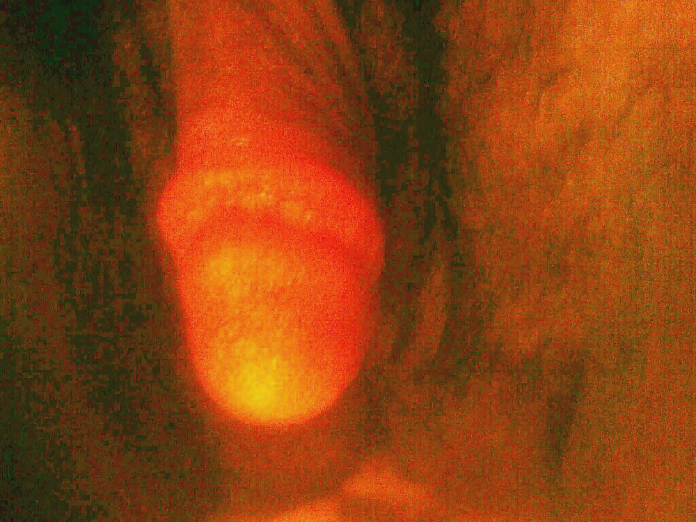 Ftm cl-ick
 #4803601