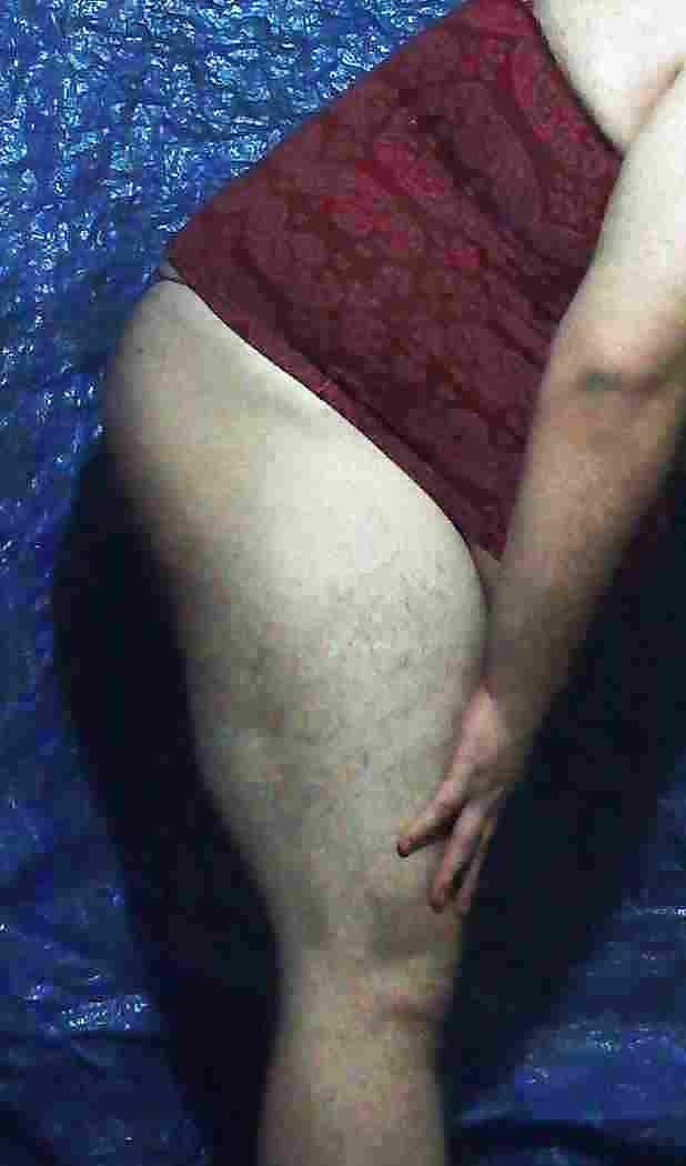 Thong #9873749