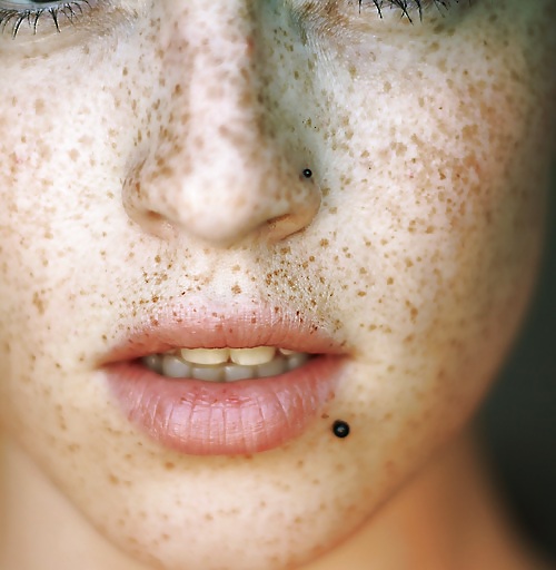 Freckles.... #12776093