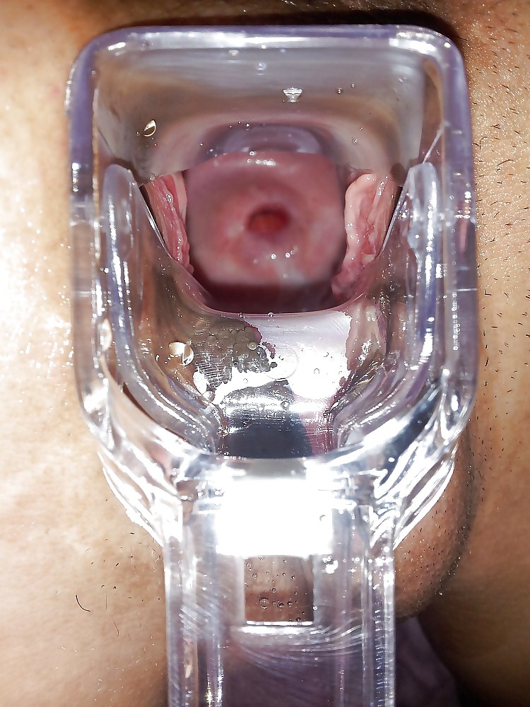 Cervix, speculum, open wide pussy