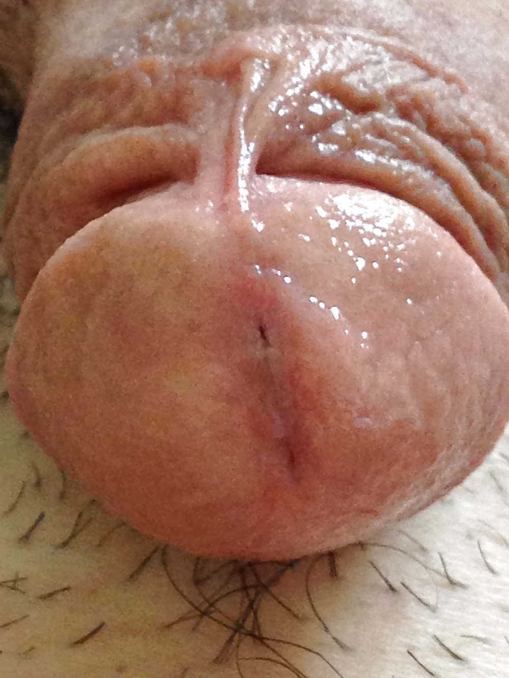 Me rackermann
 #17223913