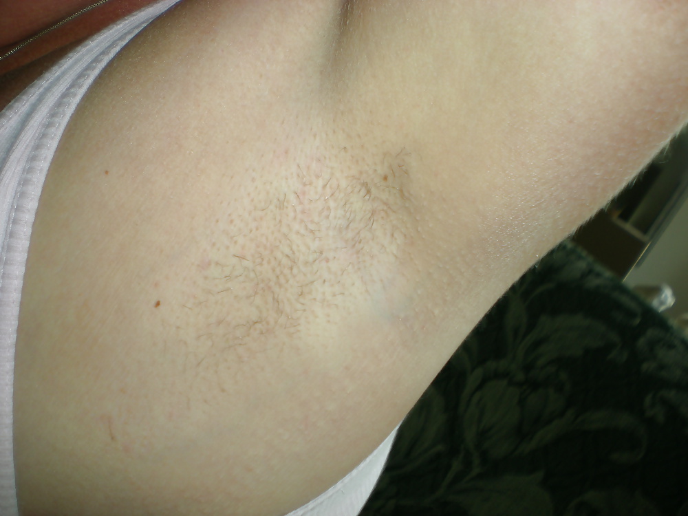 Hairy armpit #3909338