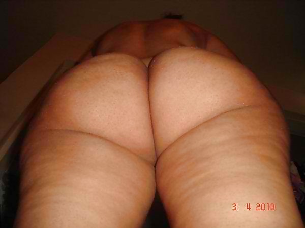 Cellulite 2 #9347762
