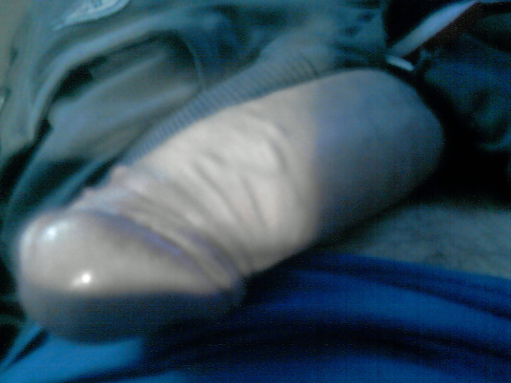 My penis  gallery 1 #20095402