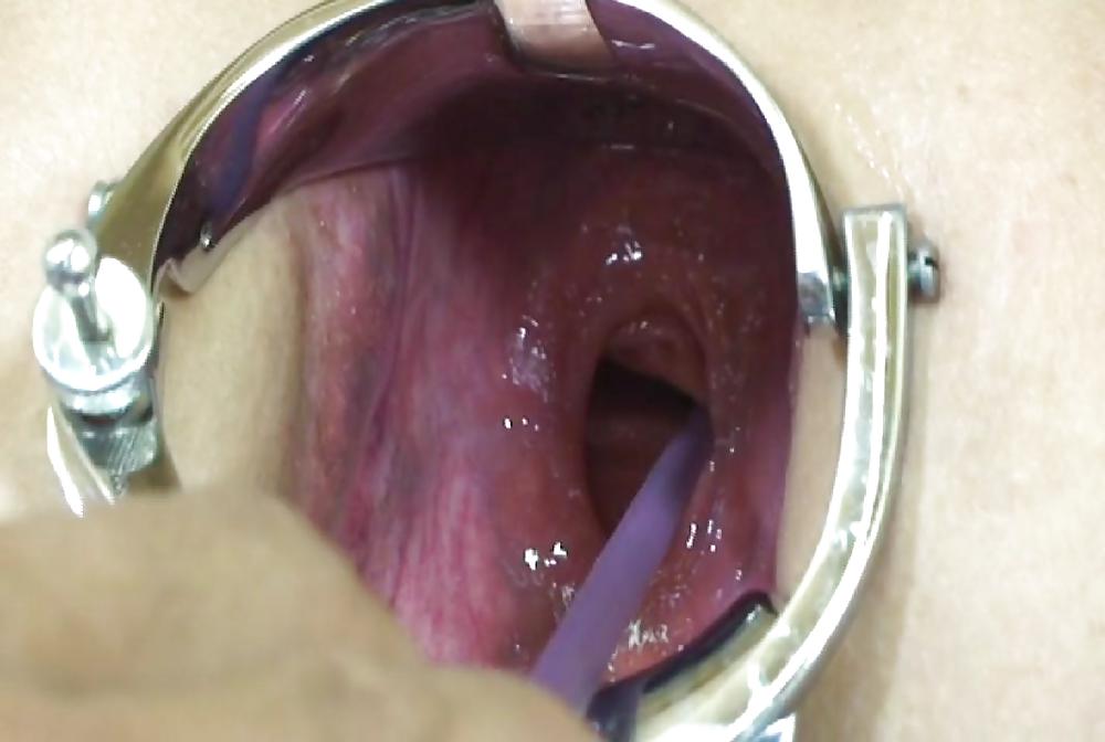 Gape and prolapse 2 #4157274