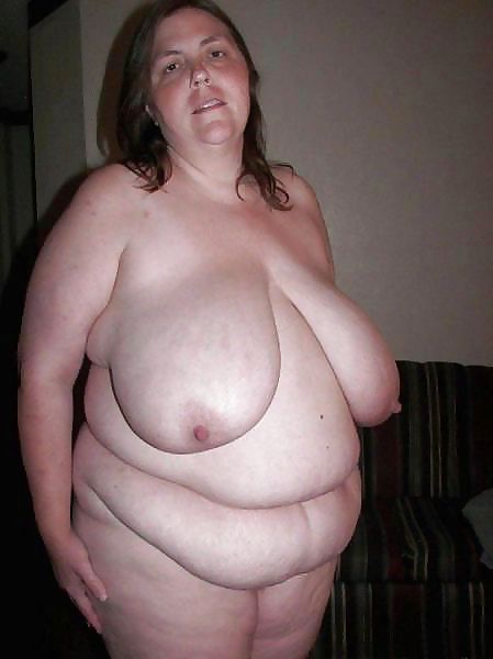 Stretch Marks, Scars and Saggy 26 #17640050