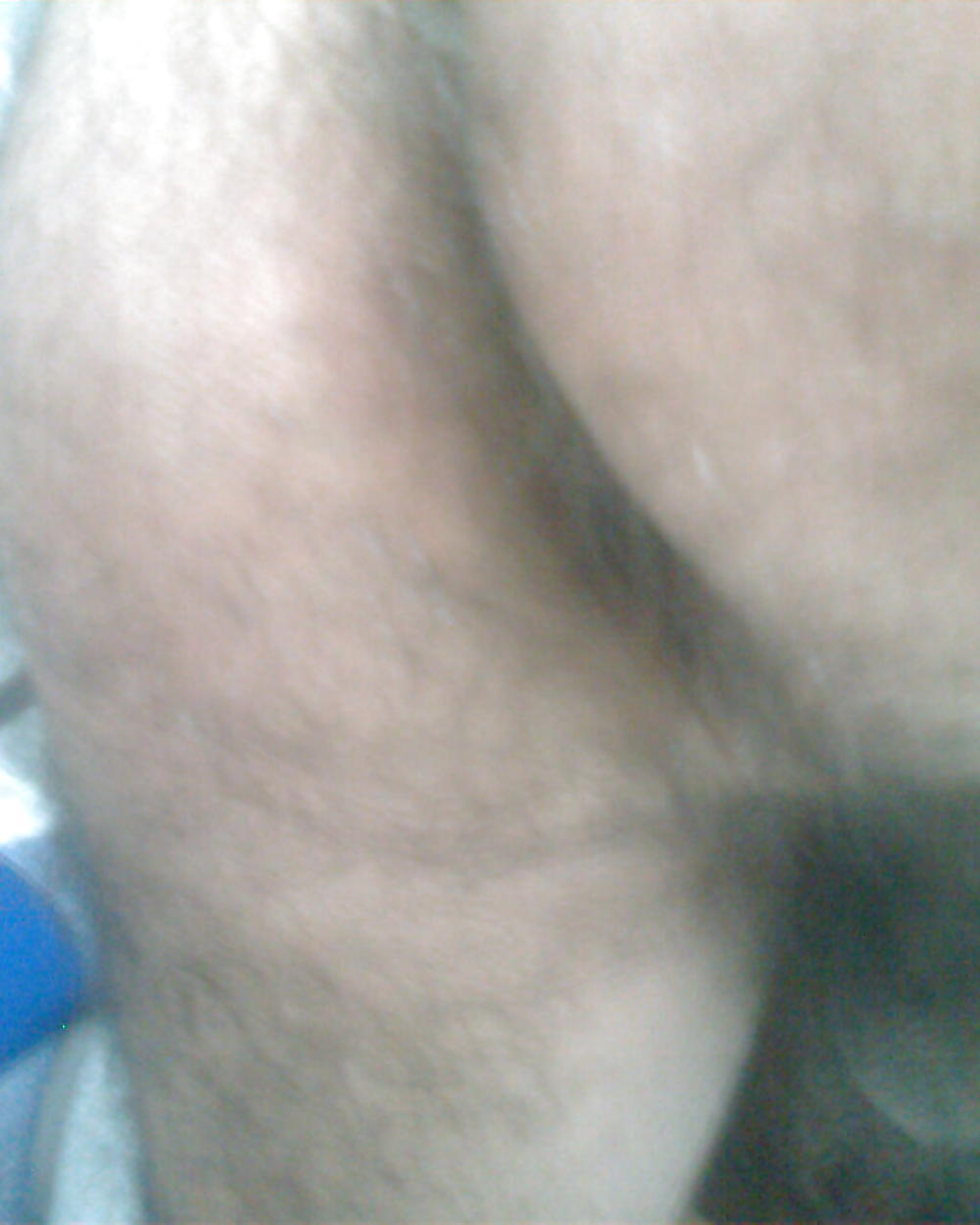 Hairy buttocks #8167058