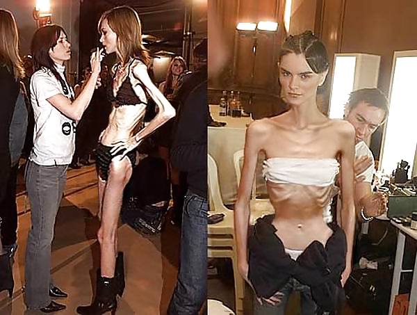 Skinny Girls #8509591