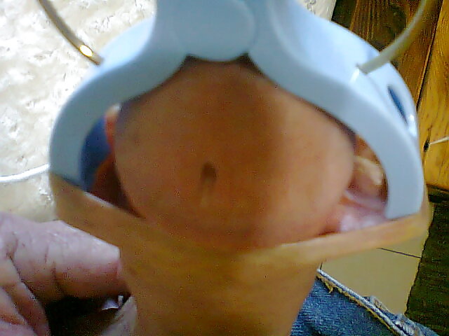 Peg extrema
 #20234739