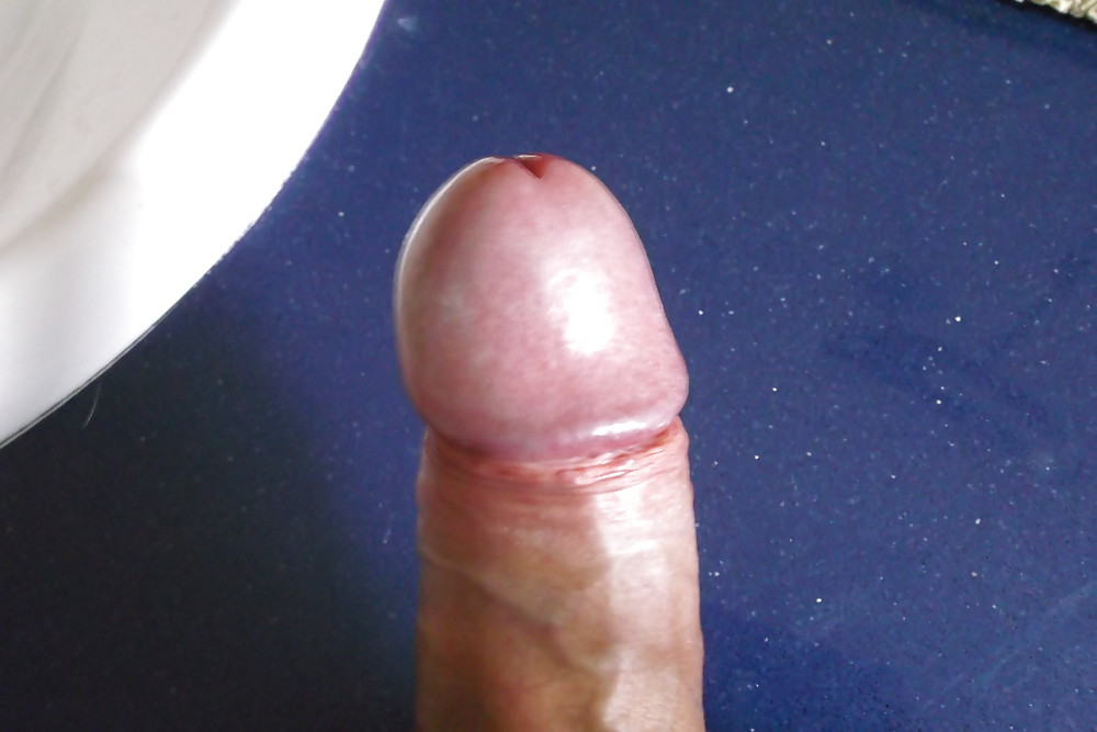 Ich #12515760