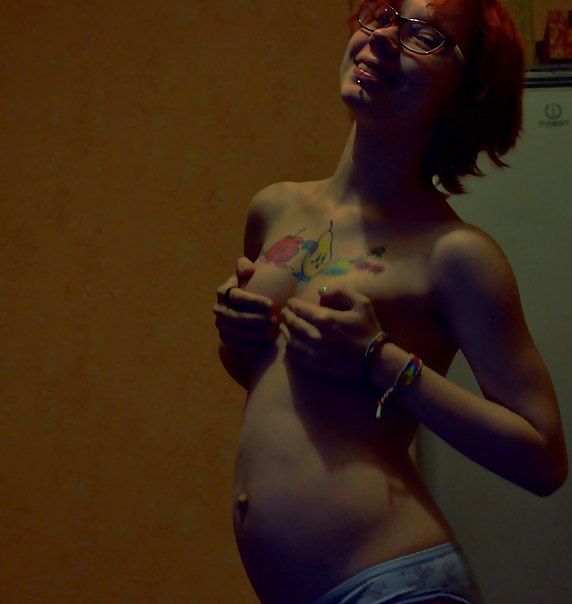 My preg #22848944