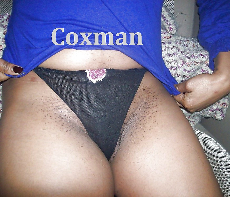 マンコのカミソリ負け
 #14338085