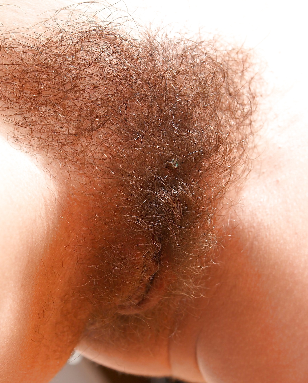 From the Moshe Files: Sweet Hirsute #15409224