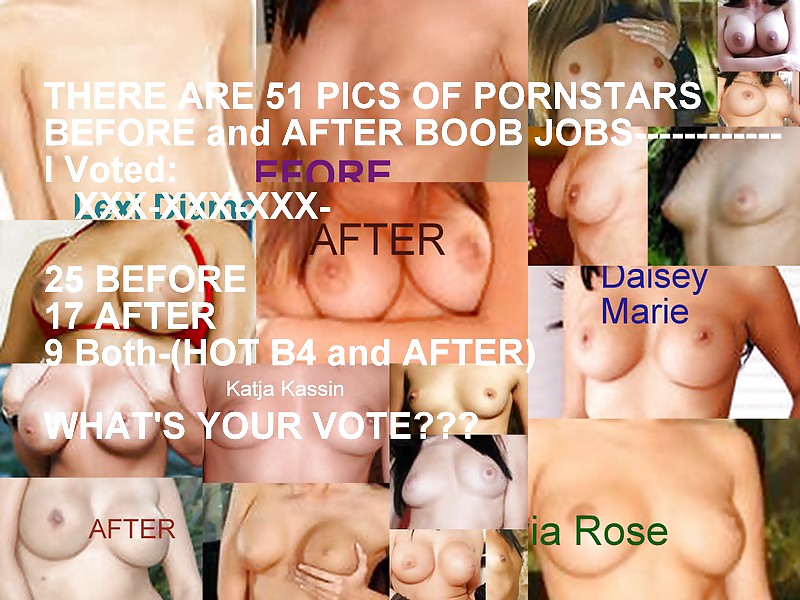 B4 and After Boob Job-Vote #21779255