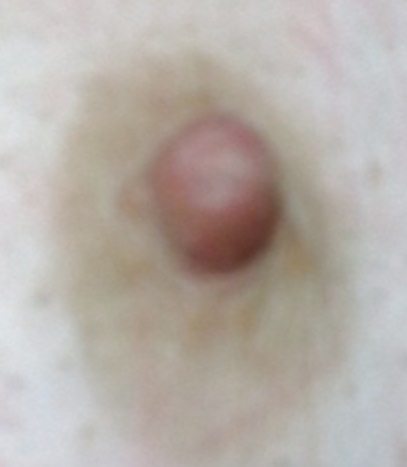 Nipple before and after #9345165