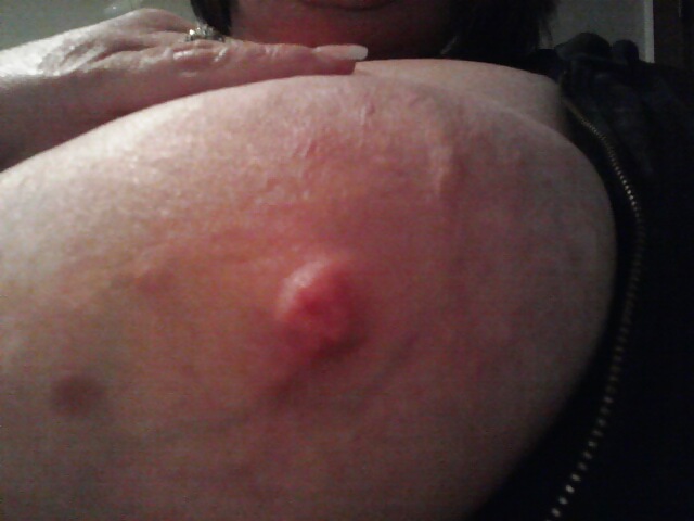 Pt 2 of bbws #8800667