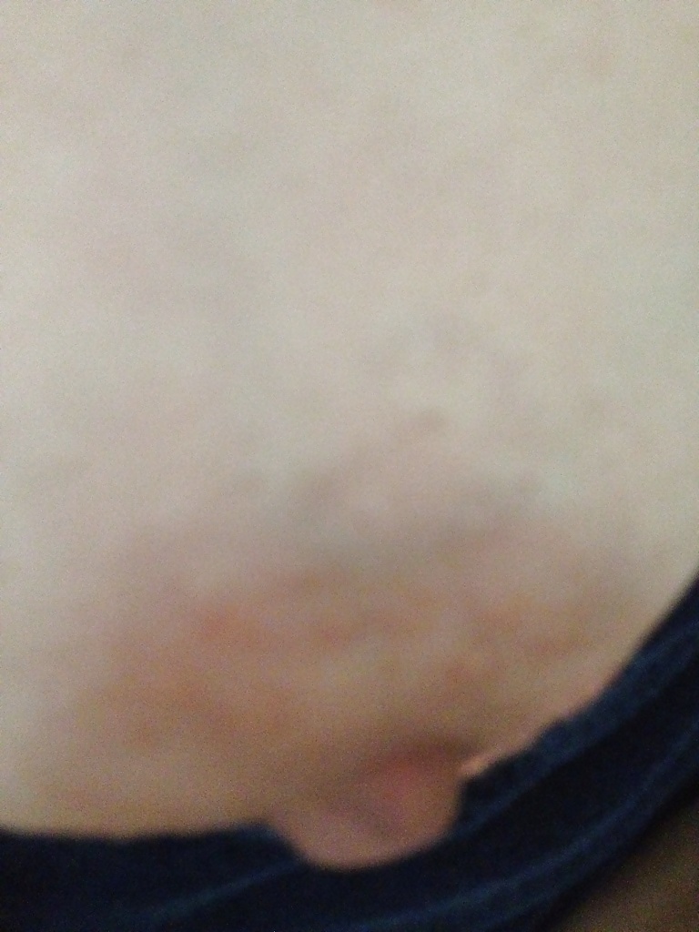 Gigantic nipple #9445010