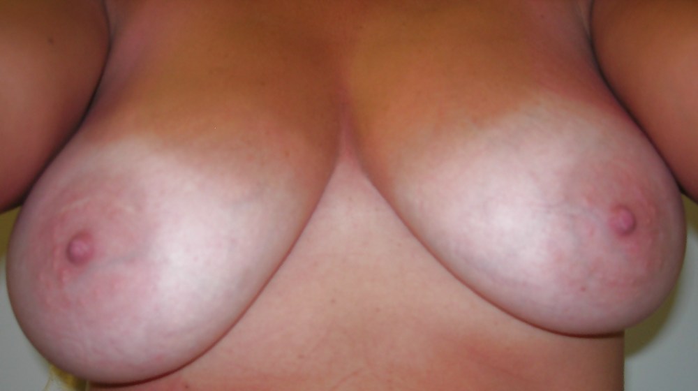 Il mio seno con linee di abbronzatura!
 #258130