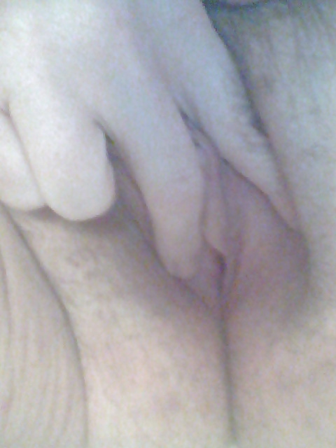 Pus pics #8341376