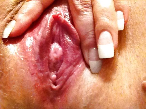 Carne abierta
 #10255428