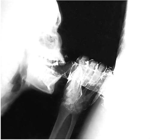 X-Ray #3945219