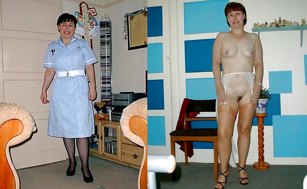 Before after 331. #3671825