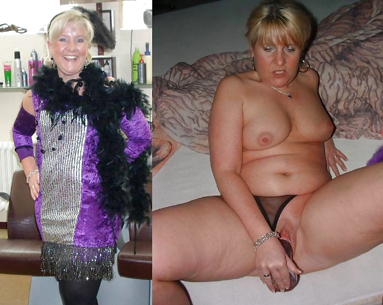 Before after 331. #3671888