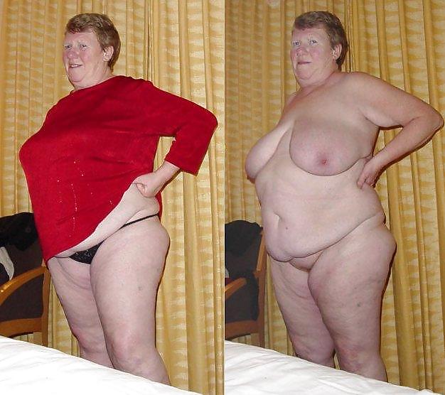 Before after 286 (Saggy tits special). #4498391