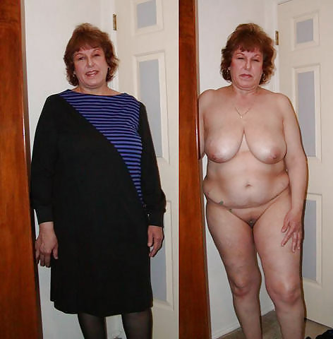 Before after 286 (Saggy tits special). #4498393
