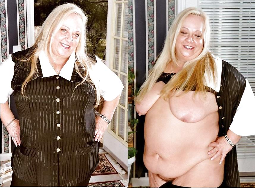 Before after 286 (Saggy tits special). #4498400