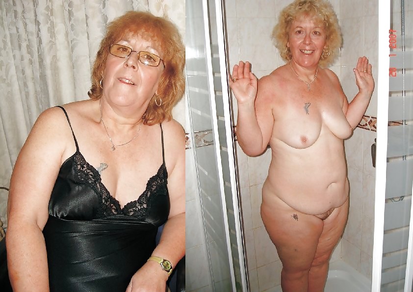 Before after 286 (Saggy tits special). #4498407