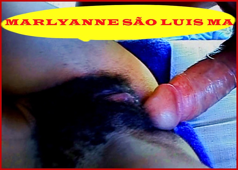 マランヘンスの足首
 #17797791