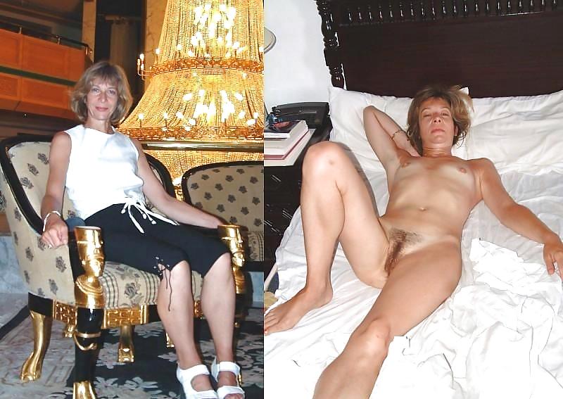 Before After 160. #4029723