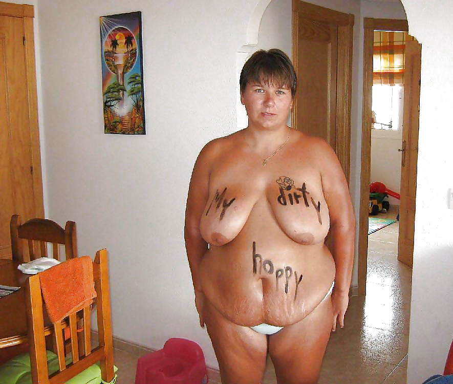 Stretch Marks, Scars and Saggy 19 #18639182