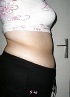 Vergeture - grossesse
 #22266338