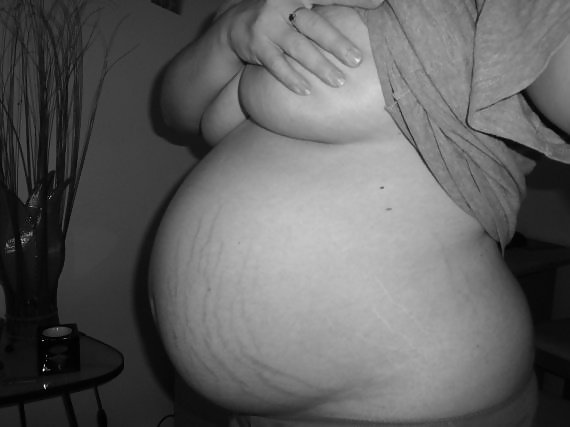 Vergeture - grossesse #22266371