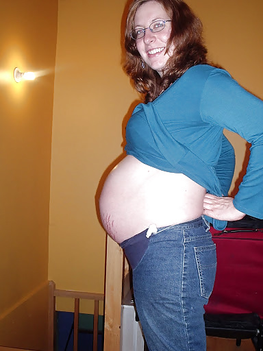 Vergeture - grossesse
 #22266381