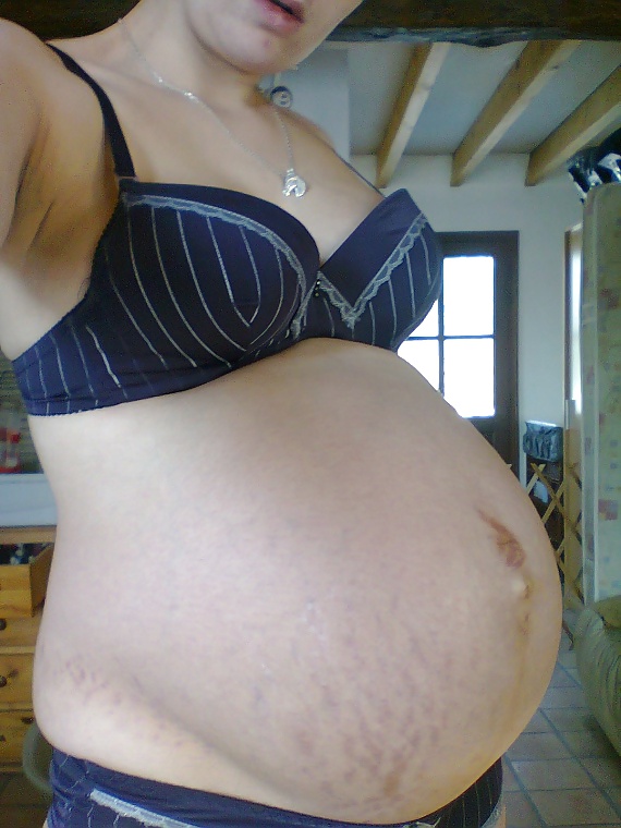 Vergeture - grossesse
 #22266389