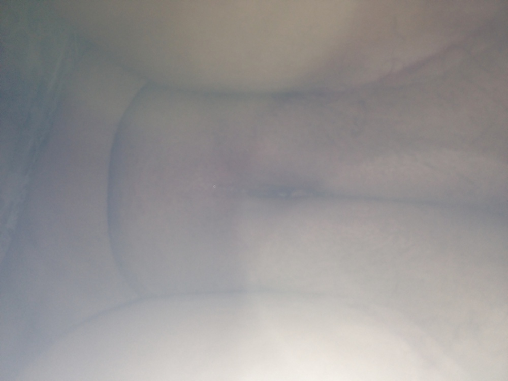 Ex 2 #21733445